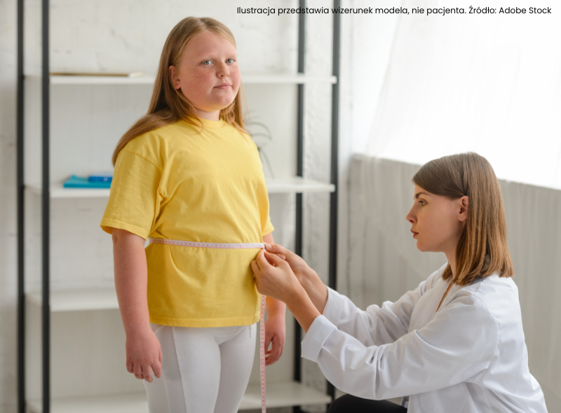 sNadwaga u dzieci – niepokojący problem naszych czasów