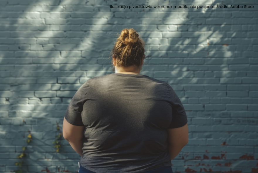 sJak przejawia się stygmatyzacja otyłości? Jak społeczeństwo postrzega osoby z nadwagą i otyłością?